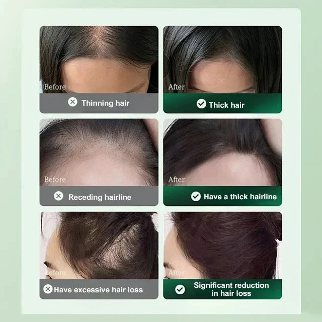 Hair Growth Solution