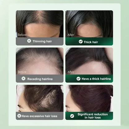 Hair Growth Solution
