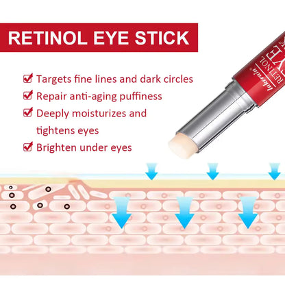 Retinol Eye Cream Stick – Dark Circle Remover & Instant Eye Repair for Women